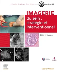 Imagerie du sein : stratégie et interventionnel