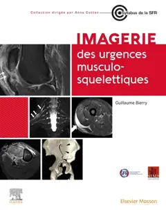 Imagerie des urgences musculosquelettiques